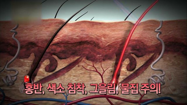 186회] 제모, 털과 함께 수분도 사라진다 | Kbs 뉴스