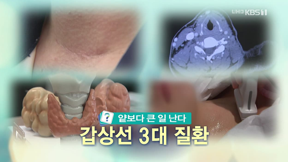 무엇이든 물어보세요 - KBS